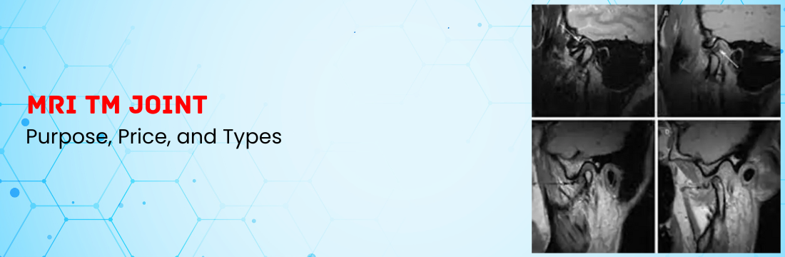 MRI TM Joint: Purpose, Price, and Types